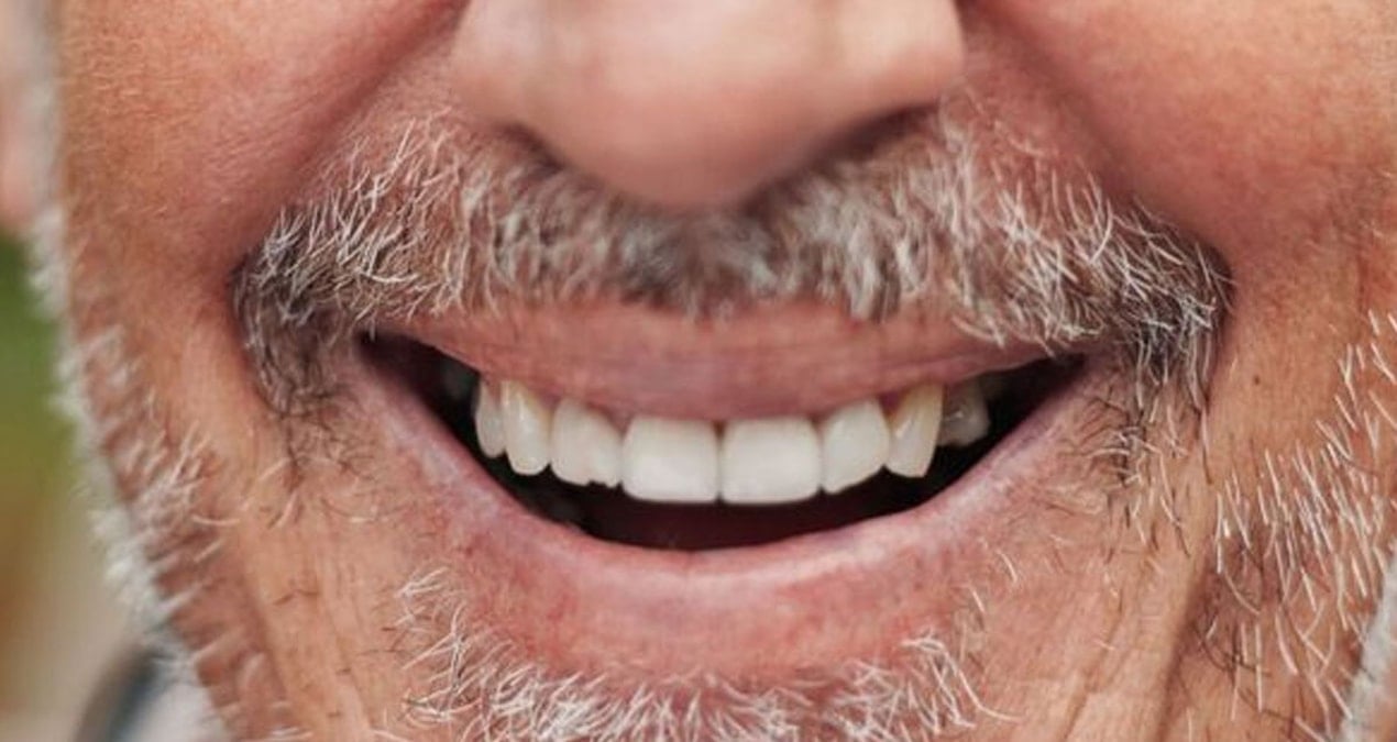 gulguljpg-UjR7Fp-HhUqyaZOauStAjQ Nadir görülen 'gülme hastalığı': Kurtulabilen yok