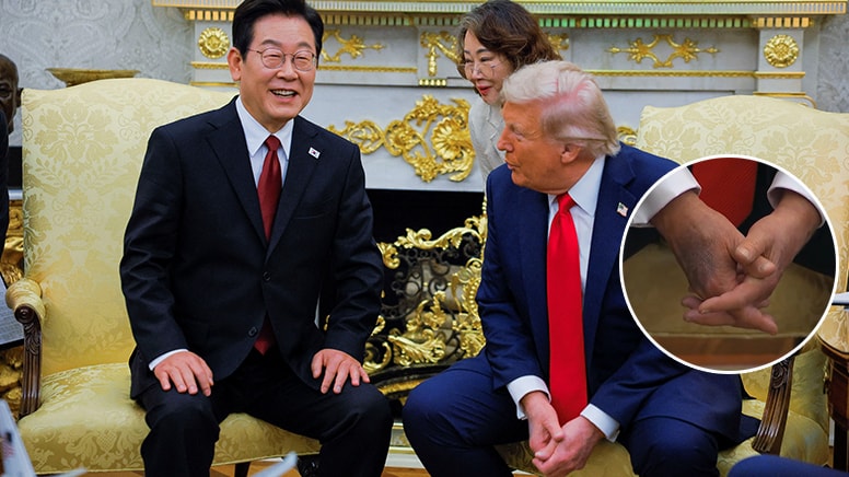 Trump'ın elindeki 'koyu leke' dikkat çekti!