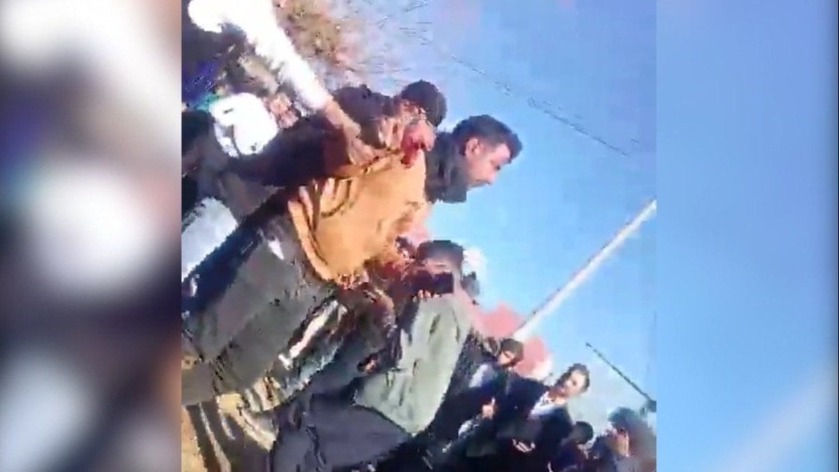 Magandalar düğünde kurşun yağdırdı davulcu hastaneye kaldırıldı