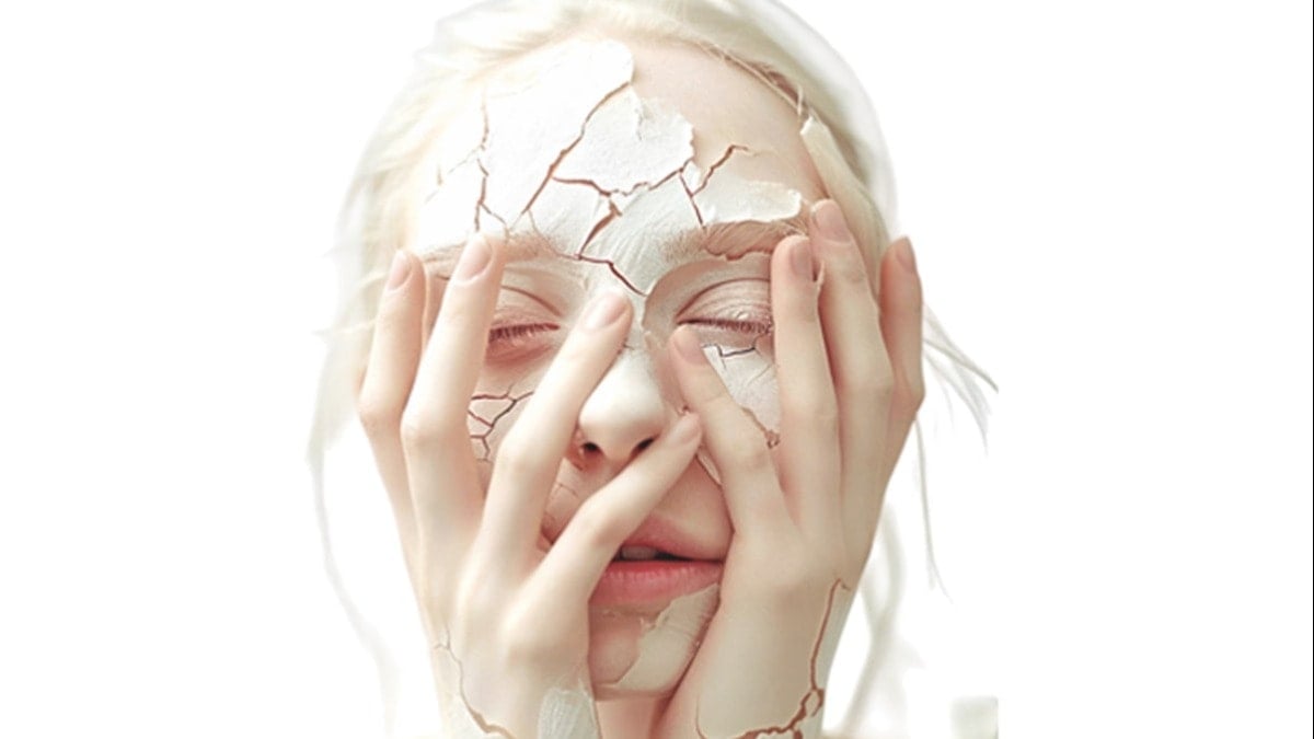 Stres cilde nasıl yansır?