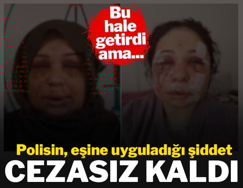 Eşini hastanelik eden polis, ifade verip serbest kaldı