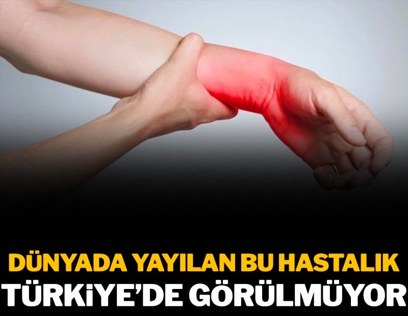 Dünyada yayılan bu hastalık Türkiye'de görülmüyor