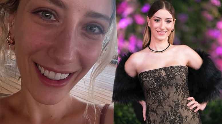 Ünlü oyuncu dişlerini söktürdü: 'Ölüyorum sandım'