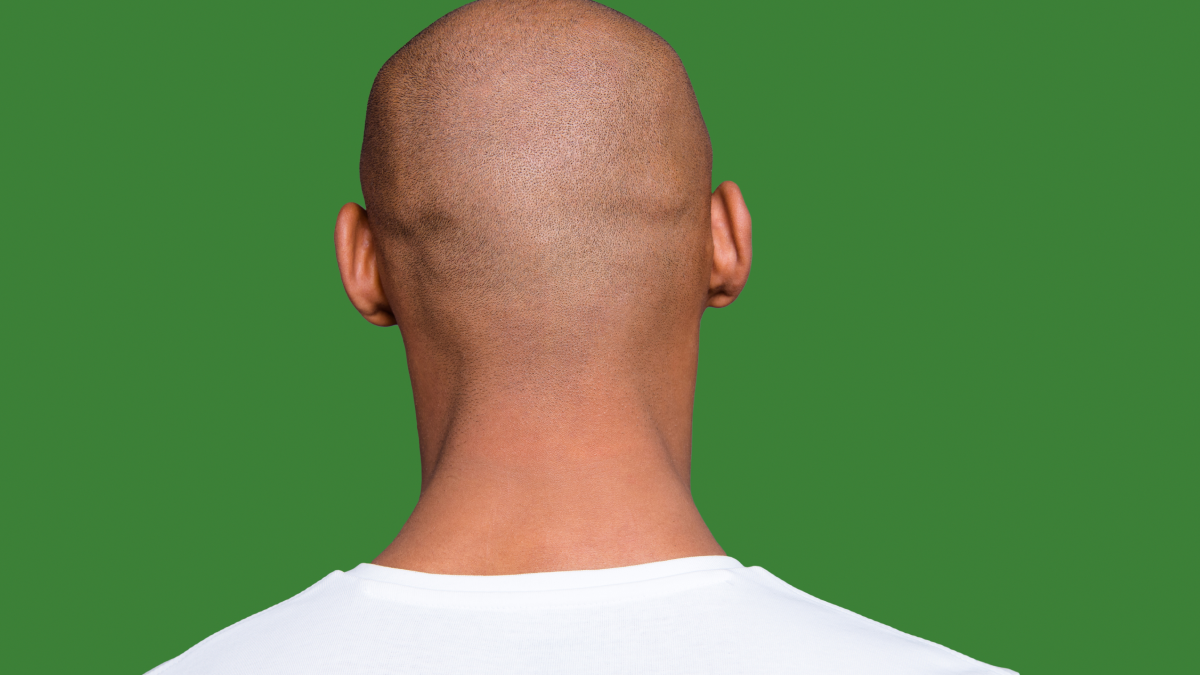 Kafa büyüklüğünüz, nörolojik hastalıklara yakalanma riskinizi gösteriyor