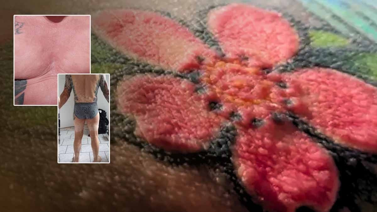 Kırmızı dövme yaptırdı, başına gelmeyen kalmadı