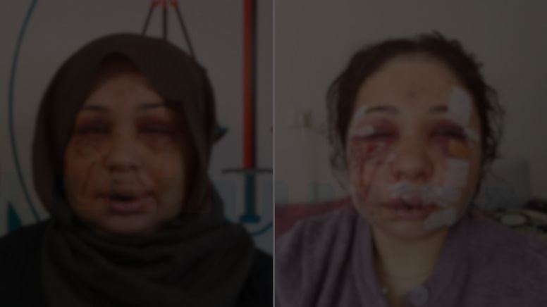 Eşini hastanelik eden polis, ifade verip serbest kaldı