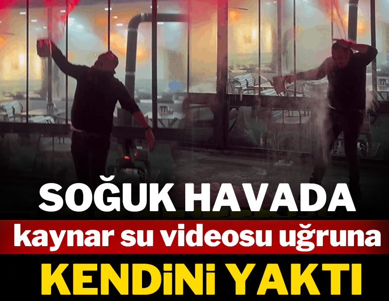 Soğuk havada kaynar su videosu uğruna kendini yaktı!