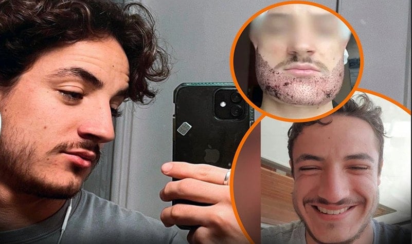 Emlakçının sakal operasyonu yaptığı İngiliz genç öldü