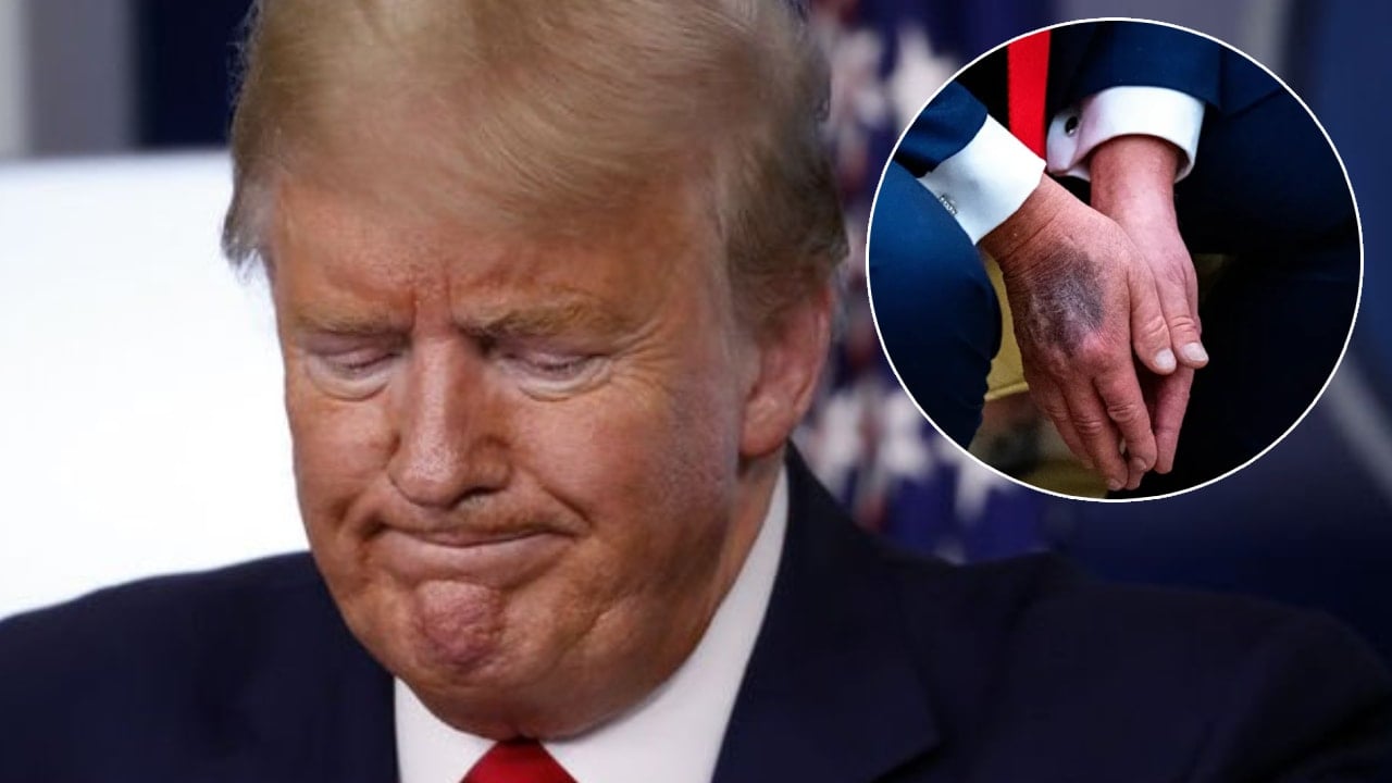 Donald Trump elindeki morluğun sebebini açıkladı!