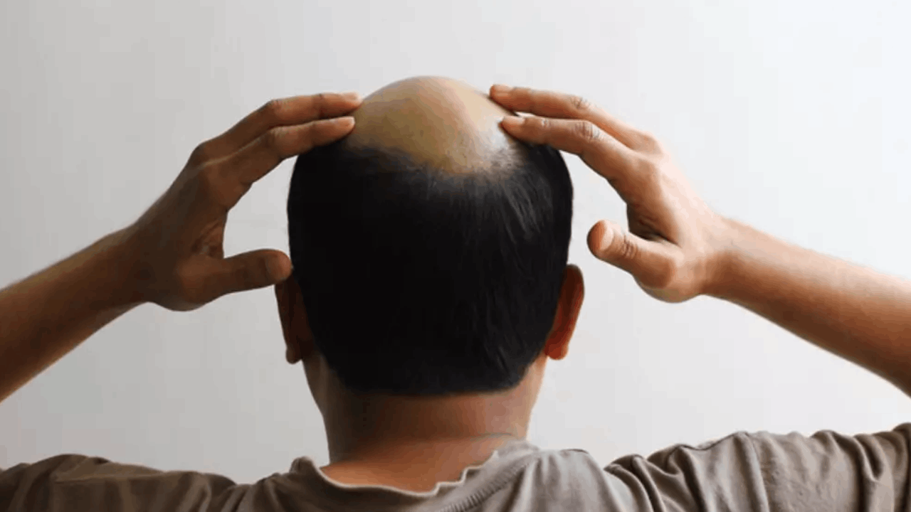 Kocasının kel olduğunu evlendikten sonra öğrendi: Soluğu karakolda aldı