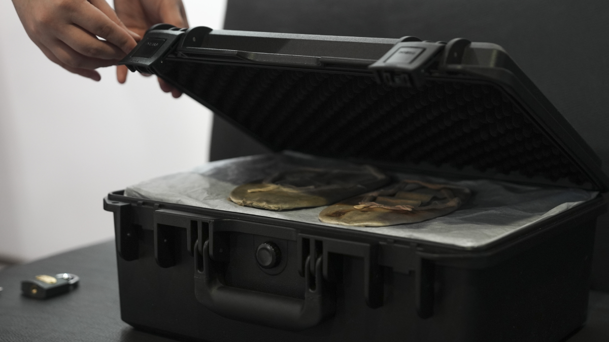 Dünya Ankaralı Özgür'ün peşine düştü! Milyonlarca liralık teklifler geliyor