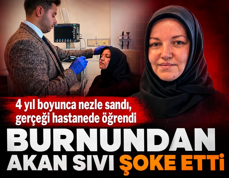 4 yıl boyunca nezle sandı, gerçeği hastanede öğrendi: Burnundan akan sıvı beyin sıvısı çıktı