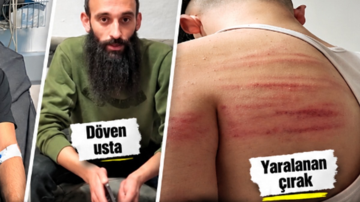 Ustalar çıldırdı: Biri ateş açtı, diğeri işkence yaptı