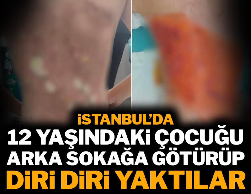 İstanbul'da 12 yaşındaki çocuğu arka sokağa götürüp diri diri yaktılar