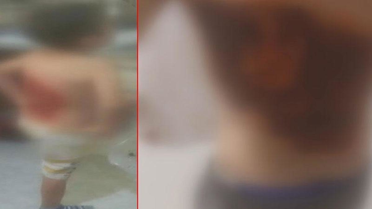 İstanbul'da 12 yaşındaki çocuğu arka sokağa götürüp diri diri yaktılar