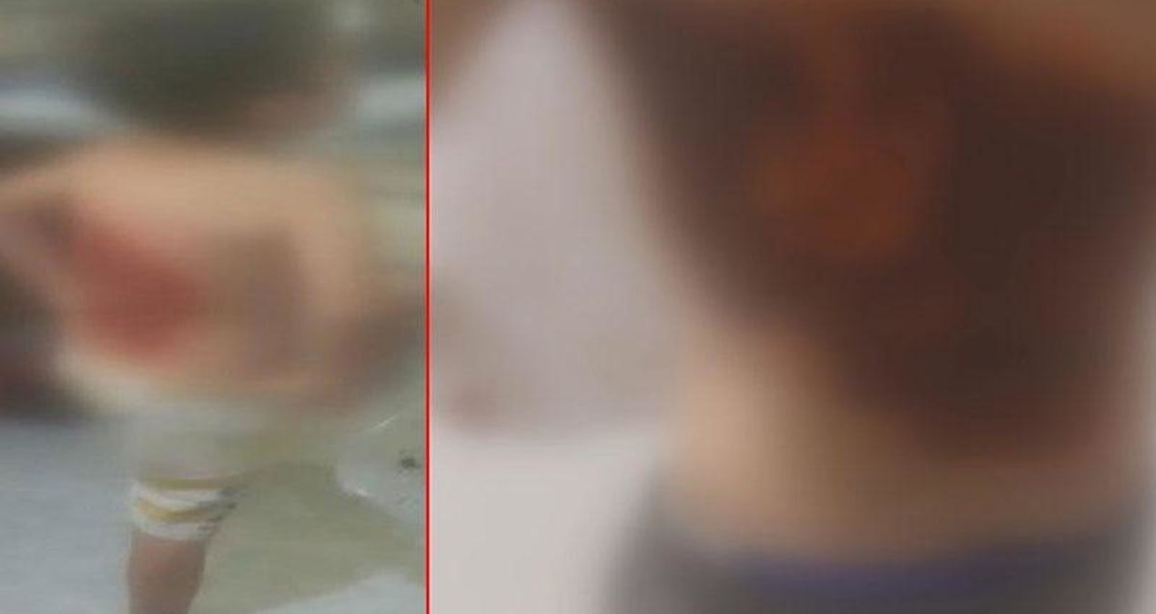 İstanbul'da 12 yaşındaki çocuğu arka sokağa götürüp diri diri yaktılar