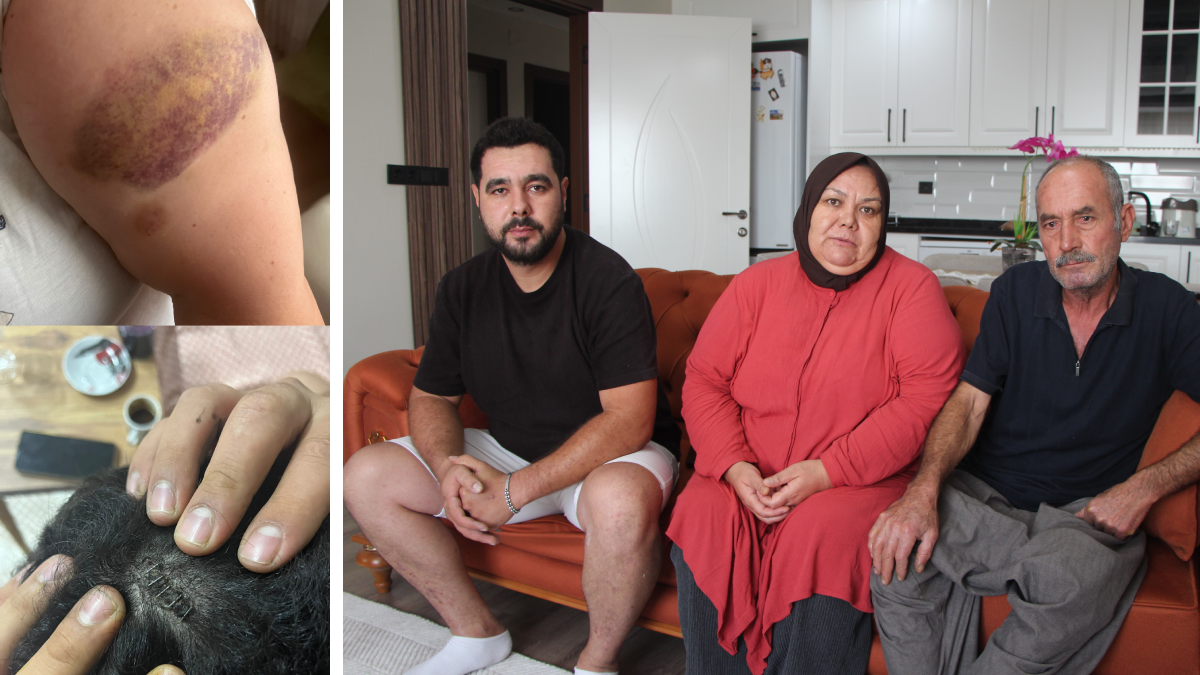 Adana'da ev basıp dehşeti yaşattılar: "Oğluma keserle, eşime zincirle saldırdılar!"