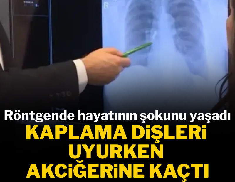 Kaplama dişleri uyurken akciğerine kaçtı 