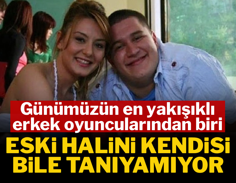 Günümüzün en yakışıklı erkek oyuncularından biri: Eski halini kendisi bile tanıyamıyor