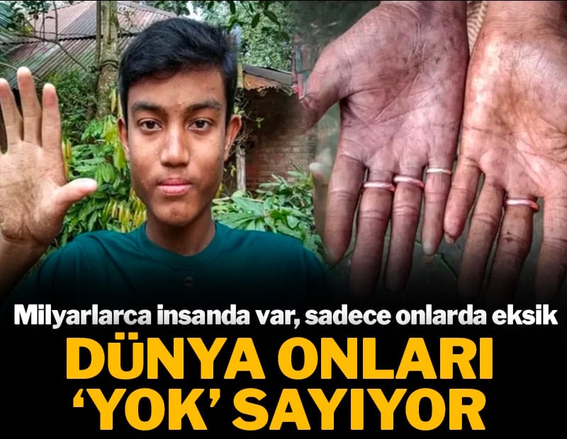 Milyarlarca insanda var sadece onlarda yok: Dünya onları 'yok' sayıyor