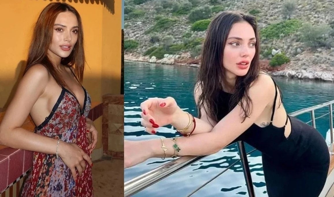 TRT dizisinde set kazası! Ünlü oyuncunun parmağı kopma noktasına geldi