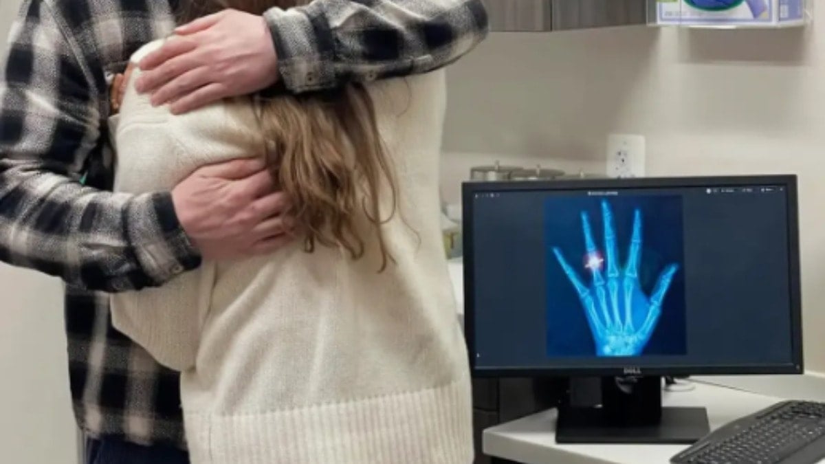 Bileğinin üzerine düştü, çektirdiği röntgen hayatının en mutlu anına dönüştü