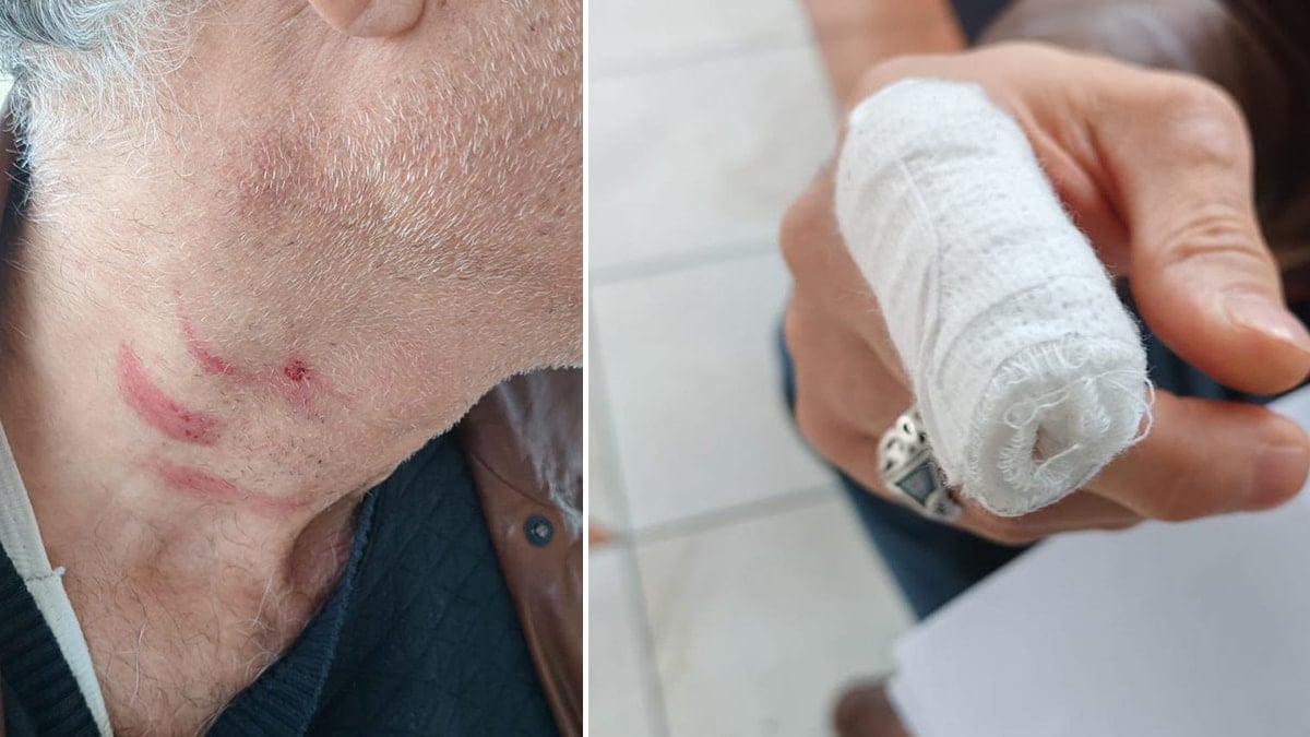 Aile hekimini döven müezzin tutuklandı