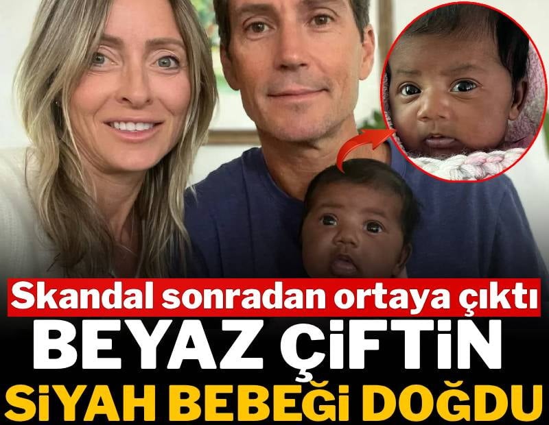 Beyaz çiftin siyah bebeği doğdu: Skandal sonradan ortaya çıktı, hayatlarının şokunu yaşadılar