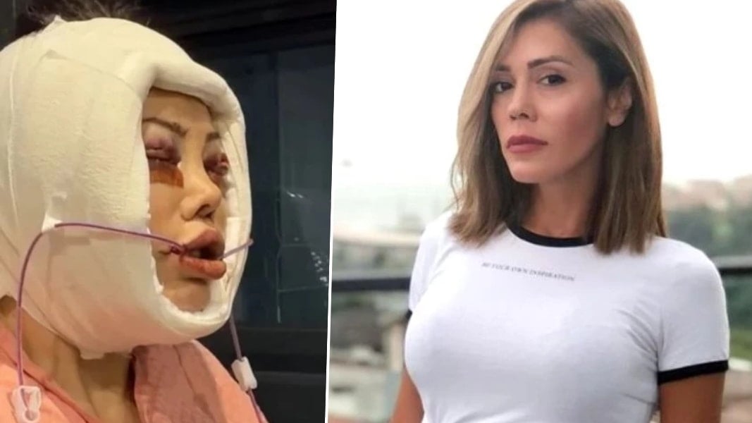 Yaptırdığı yüz nakliyle konuşulan Didem Ceran hastalığını ilk kez açıkladı