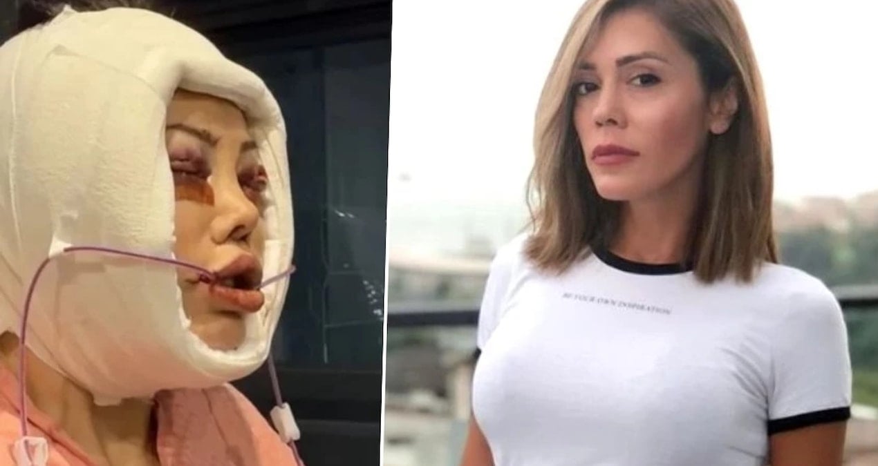 Yaptırdığı yüz nakliyle konuşulan Didem Ceran hastalığını ilk kez açıkladı