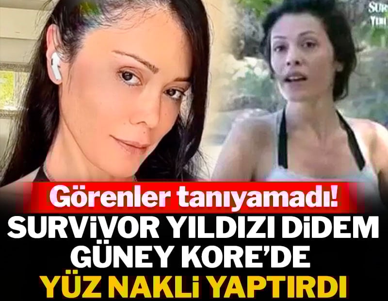 Survivor'ın eski yarışmacısı yüz nakli yaptırdı