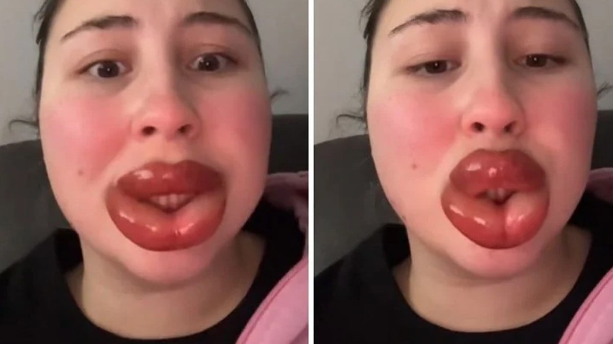 Kalıcı makyaj yaptırıp bu hale geldi: Son darbeyi erkek arkadaşı vurdu