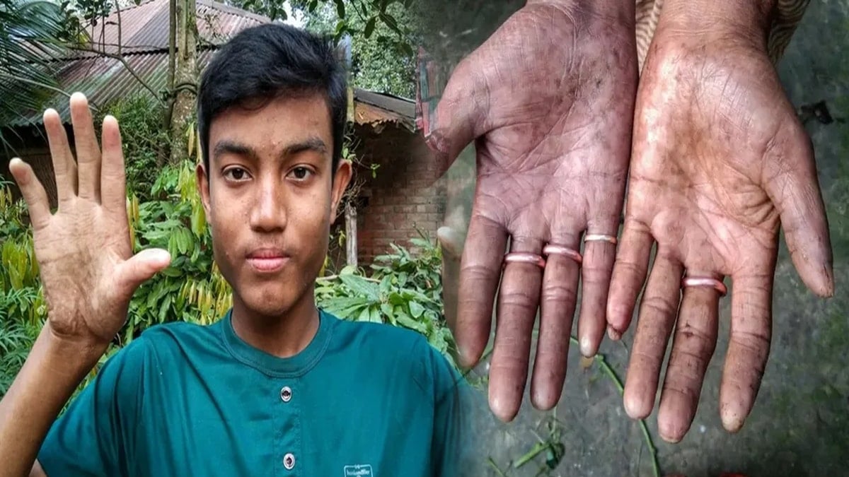 Milyarlarca insanda var sadece onlarda yok: Dünya onları 'yok' sayıyor