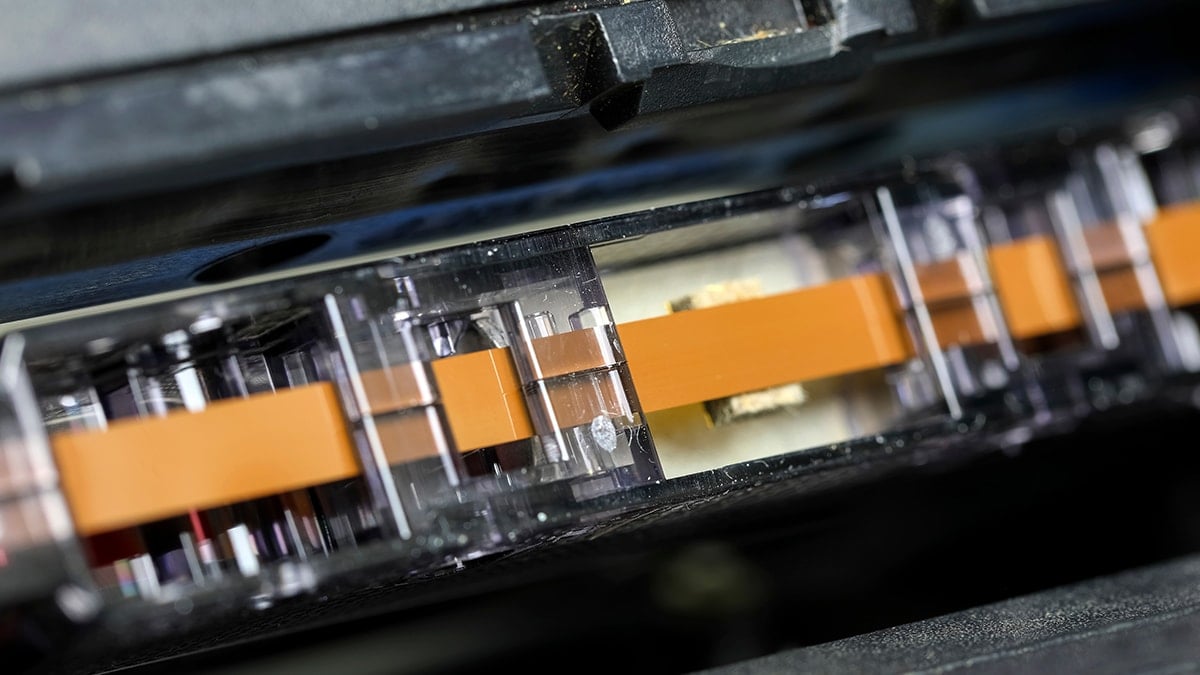 Elinde olan yaşadı: Tek bir tanesi 160 bin lira