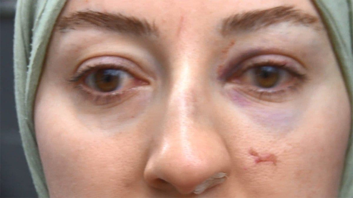 Çığlığı duyan koştu... Video kaydediyor diye kadını bu hale getirdiler