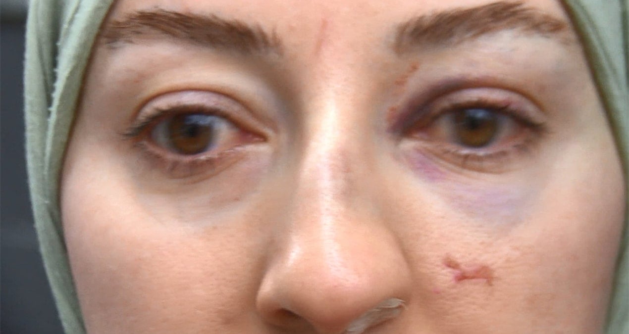 Çığlığı duyan koştu... Video kaydediyor diye kadını bu hale getirdiler