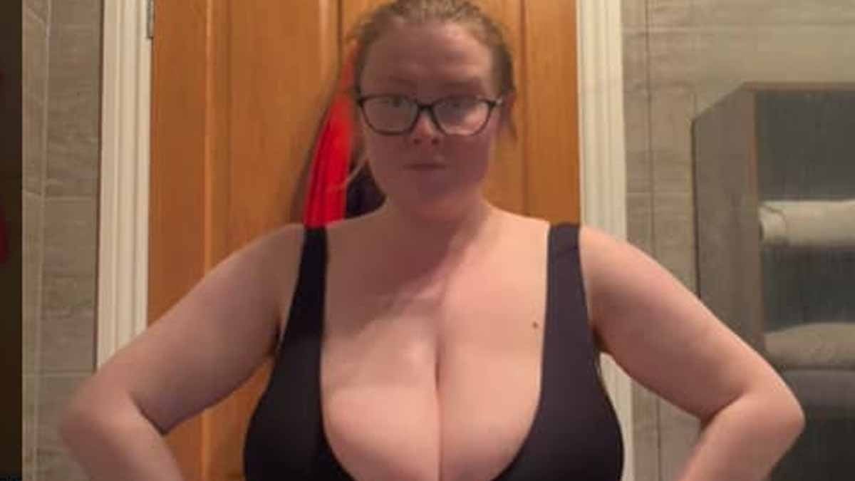 Zayıflarken göğüsleri büyüdü: Dünyada 300 kişide var