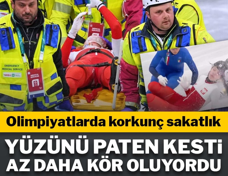 Olimpiyatlarda korkunç kaza! Az daha kör oluyordu