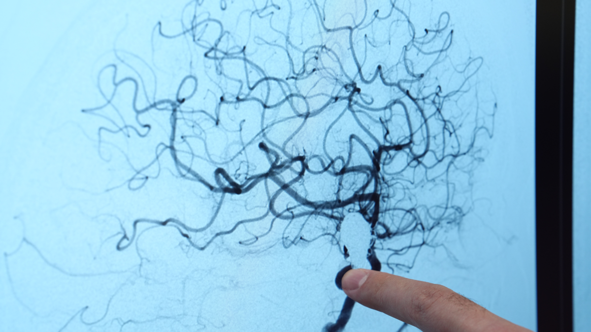 Doktorlar uyardı, her 20 kişiden 1'inde görülüyor