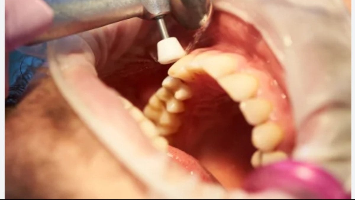 Diş yaptırmak isterken evsiz kaldı! İcra memurları evini ve arabasını haczetti