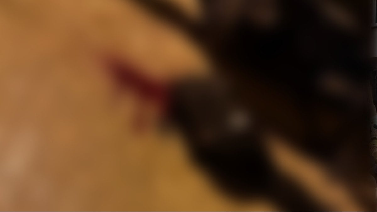 Sokakta yürürken tabanca ile başından vuruldu