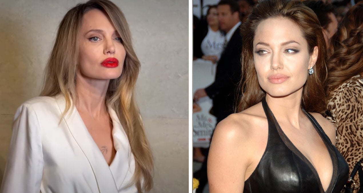 Kimi estetik, kimi dublör sandı: Angelina Jolie'nin yüzündeki değişim şaşırttı!