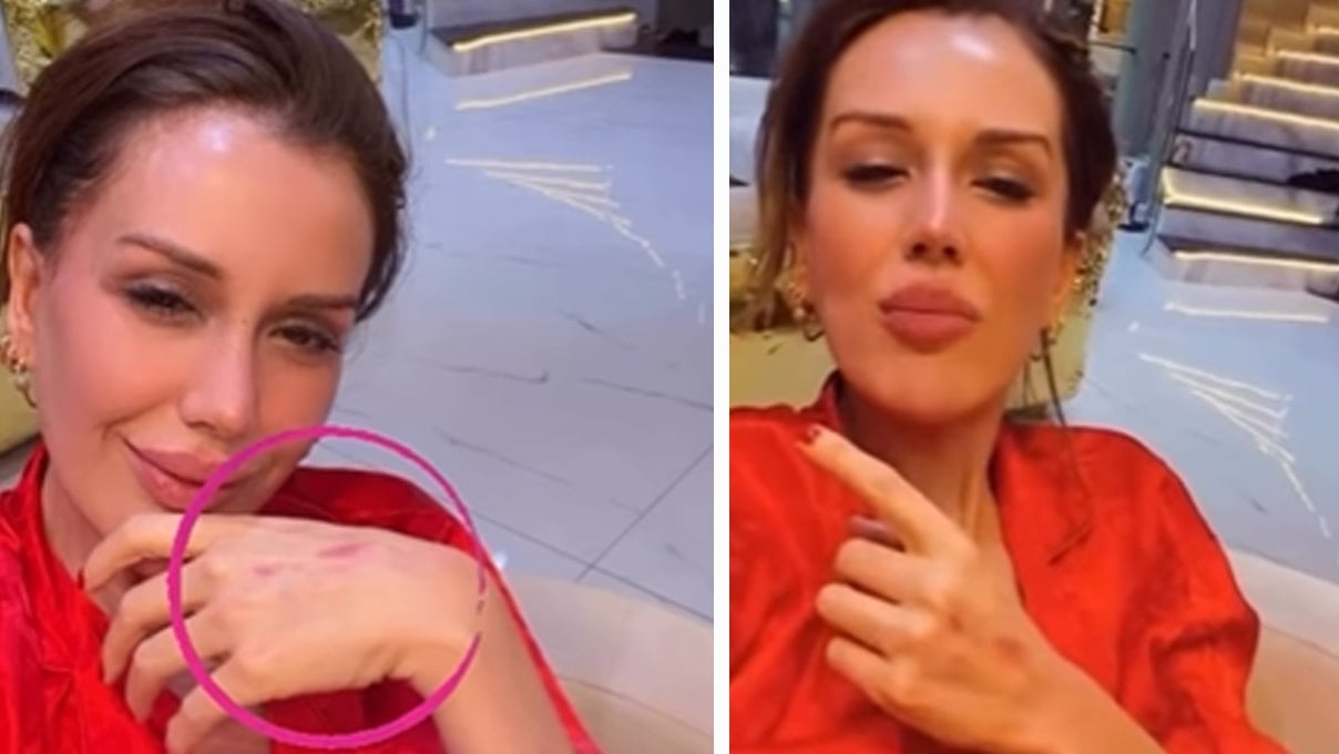 Elleri çizik içinde kaldı: Apar topar sosyal medyayı kapattı