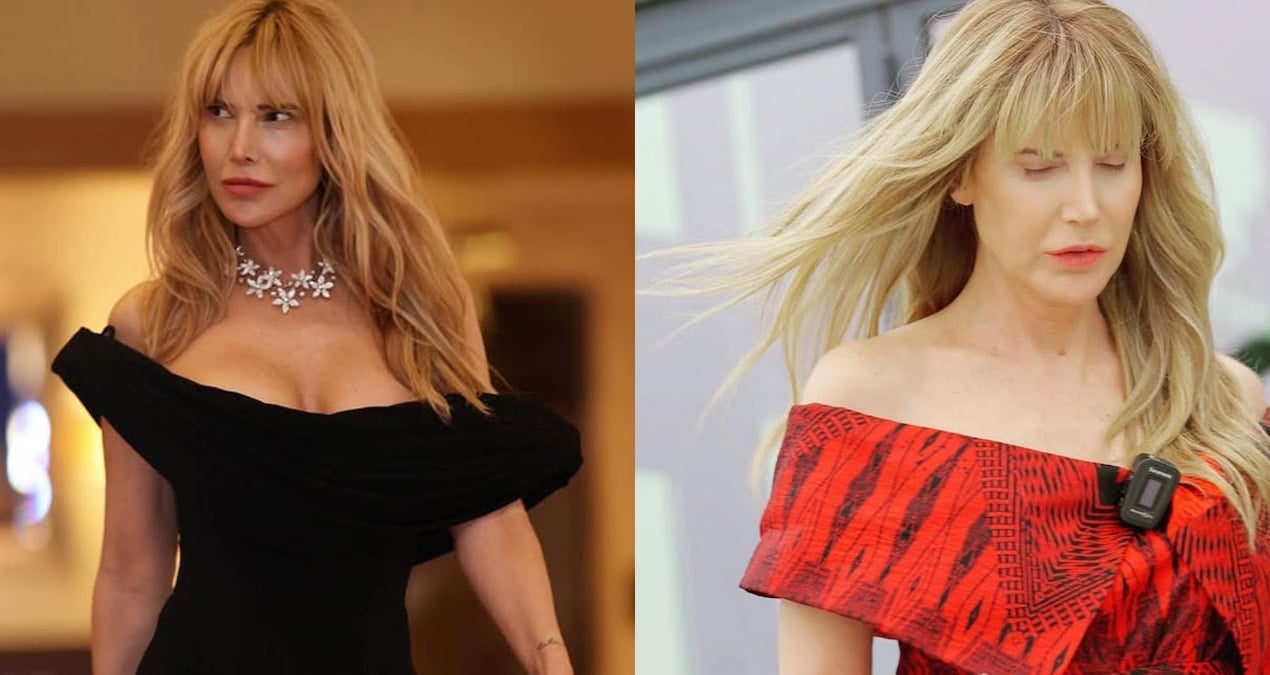 ABD’de estetik operasyon! Sosyetik isim Elif Dürüst’ün yeni hali merak konusu