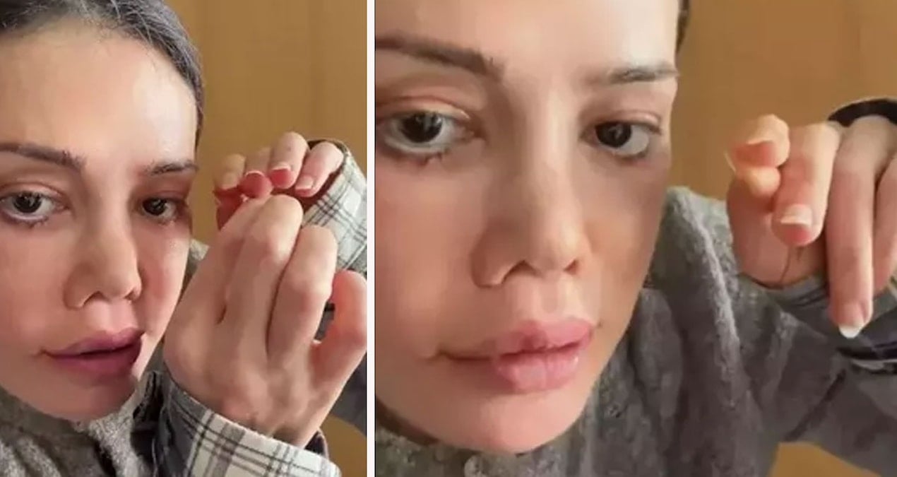 Kaşında saç çıktı! “Biri bana açıklasın” diyerek gündem oldu