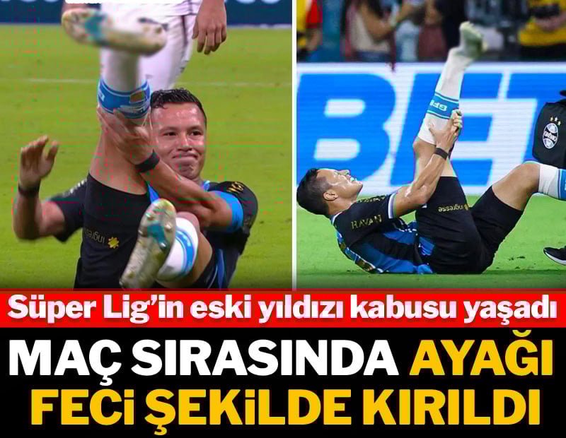 Süper Lig'in eski yıldızının talihsiz anı: Ayağı kötü şekilde kırıldı