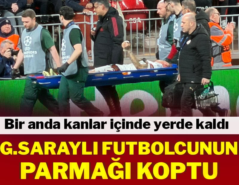 Galatasaraylı futbolcunun parmağı koptu