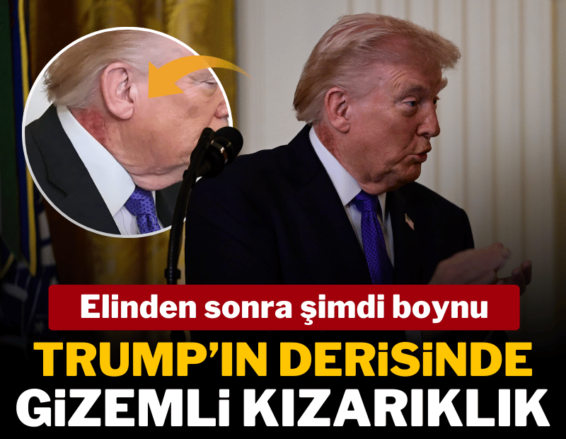 Elinden sonra şimdi boynu