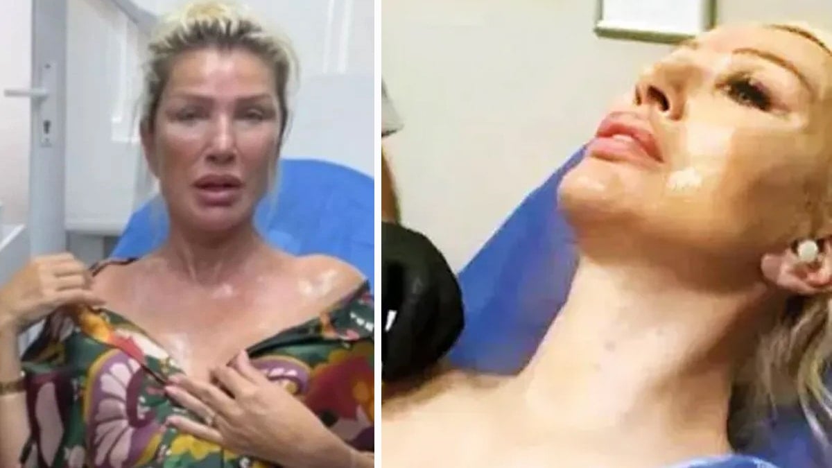 Güzellik sırrını açıkladı: Tavada pişen et gibi yaktırmış