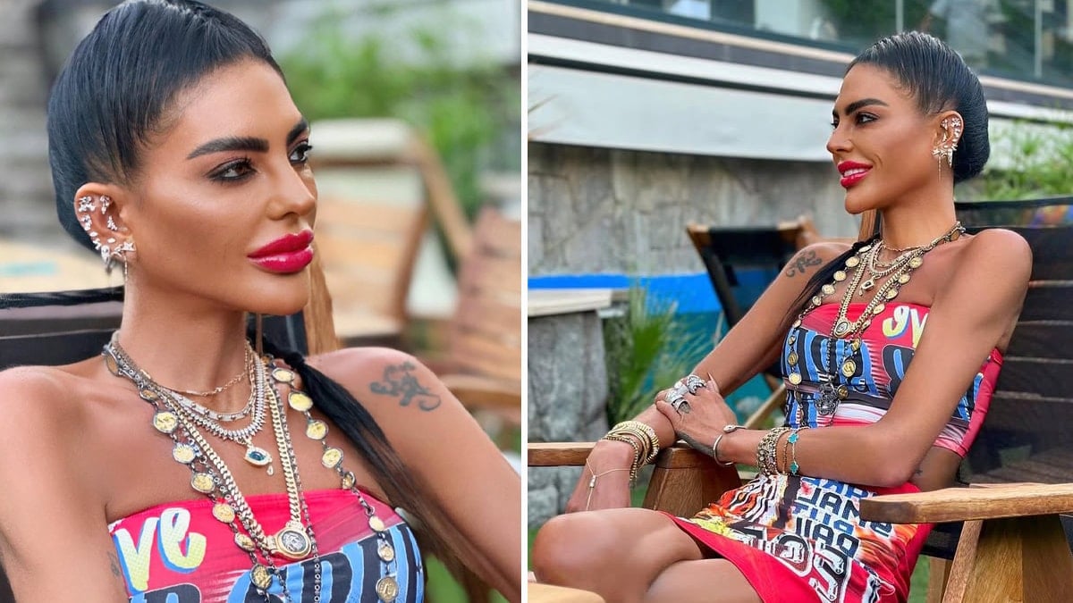 Zayıflığı bu kez korkuttu: Sosyetik isim bir deri bir kemik kaldı